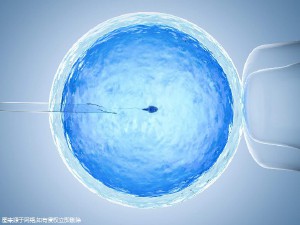 试管代怀生子助孕代妈